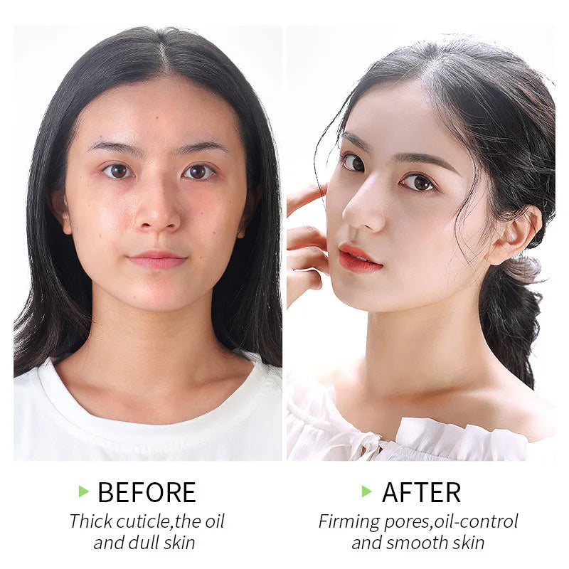 Matcha Exfoliating Peeling Gel