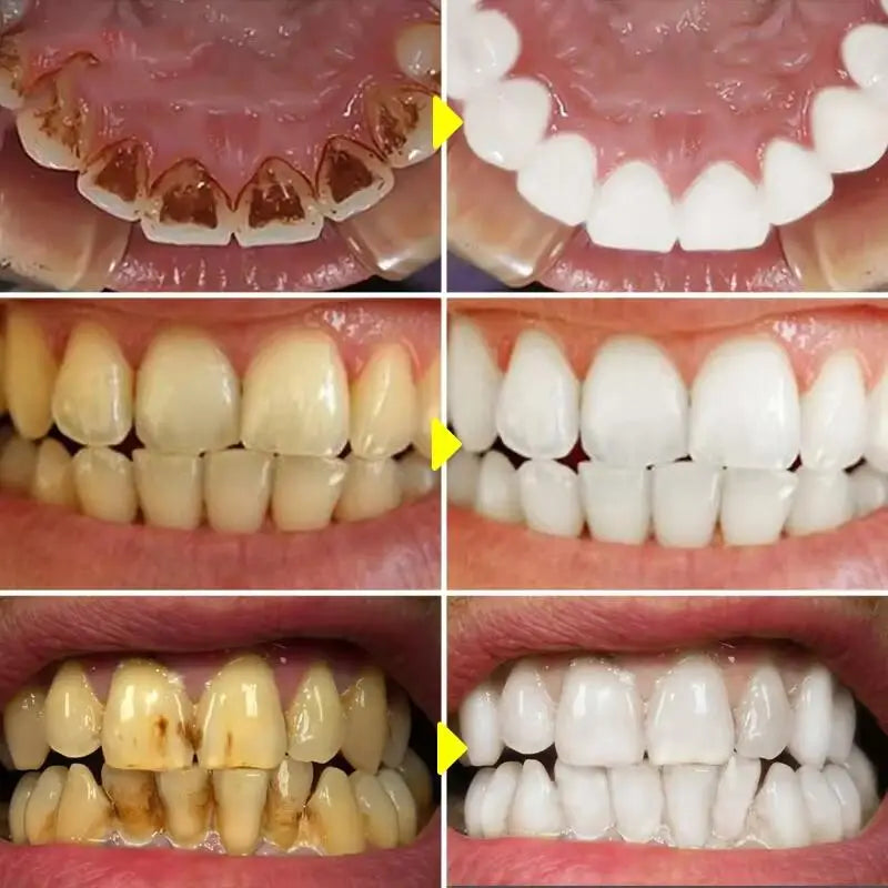 One Minute WhiteTeeth Powder