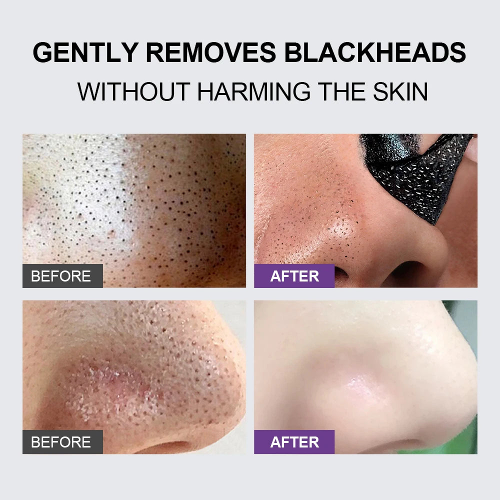 Blackhead Remover Nose Face Mask